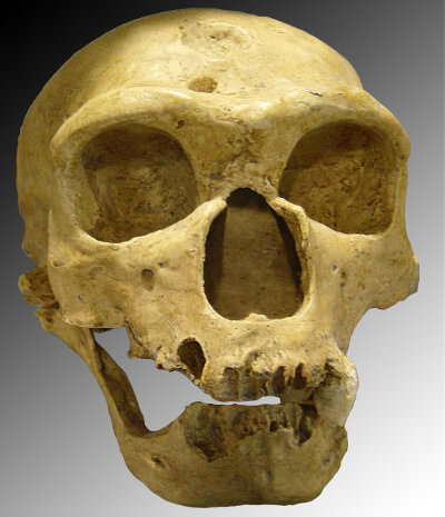 Data-driven research shows that Neanderthal gene connected to severity of COVID-19 (Update)